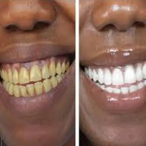 Dentifrice Essencelle par Chogan au charbon actif blanchissant avec tube blanc et noir, visible en gros plan.